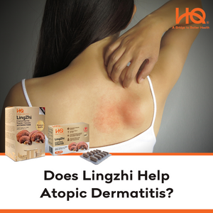 Does Lingzhi Help Atopic Dermatitis?