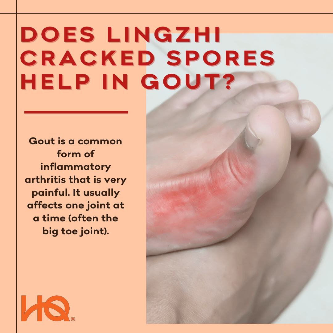 Does Lingzhi Cracked Spores help in gout? - HQ Lingzhi Singapore
